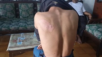 Santri Tuna Wicara Gresik Diduga Diserang: Kasus Perundungan Terungkap